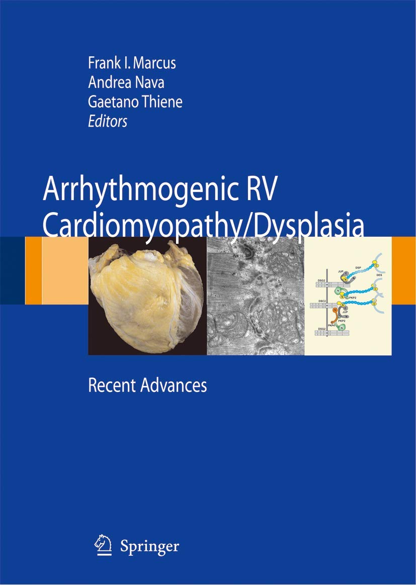Arrhythmogenic RV Cardiomyopathy/Dysplasia: Recent Advances - Retail Maharaj