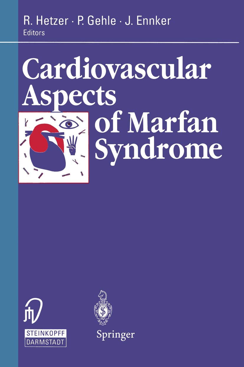 Cardiovascular Aspects of Marfan Syndrome - Retail Maharaj