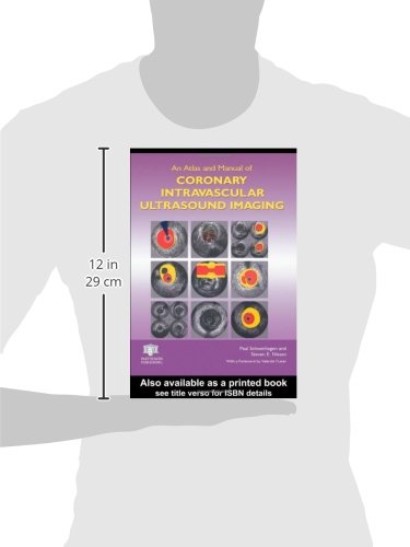 ATL & MAN CORO INT ULT IMAG - Retail Maharaj