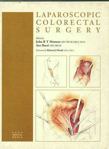 Laparoscopic Colorectal Surgery - Retail Maharaj