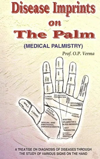 Disease Imprints on The Palm (Medical Palmistry) - Retail Maharaj
