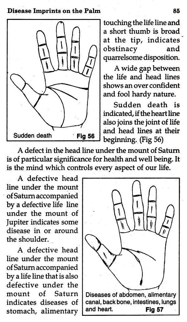 Disease Imprints on The Palm (Medical Palmistry) - Retail Maharaj