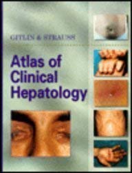 Atlas of Clinical Hepatology - Retail Maharaj