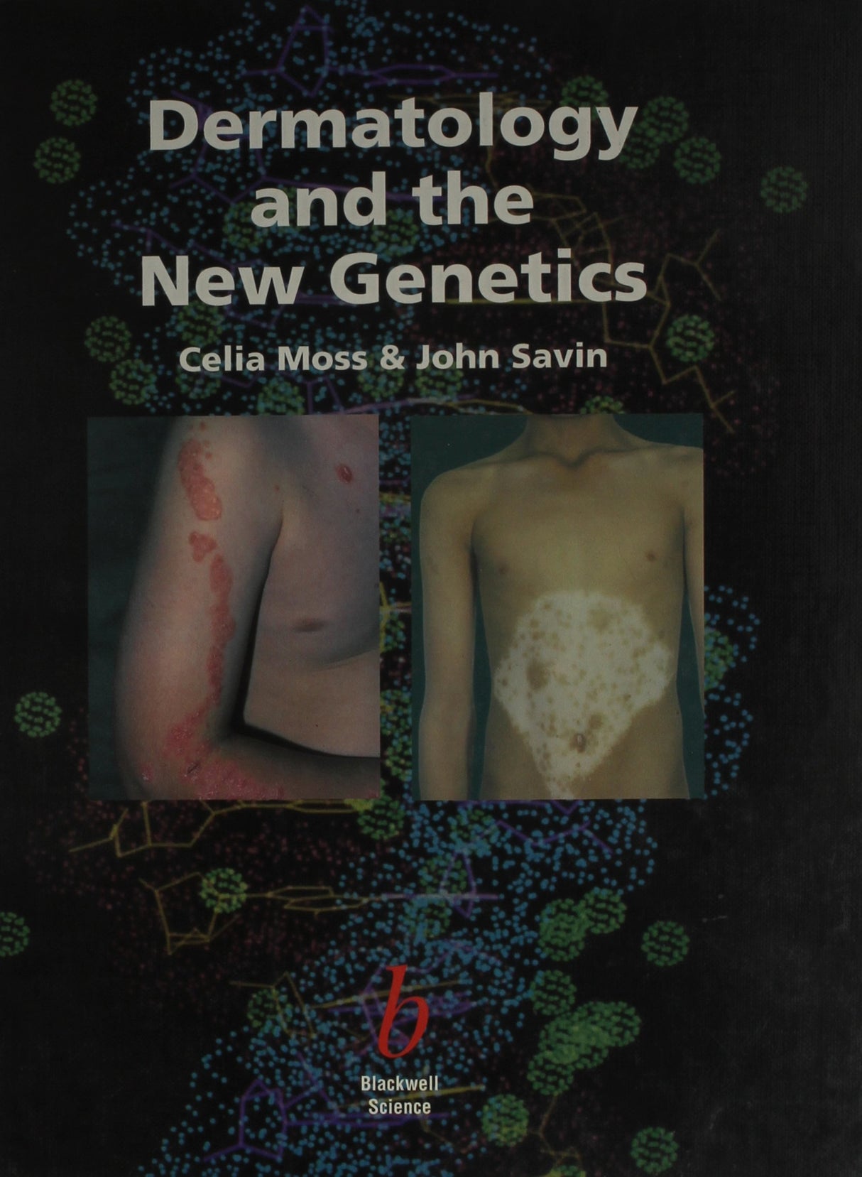Dermatology and the New Genetics - Retail Maharaj