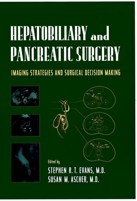 Hepatobiliary and Pancreatic Surgery: Imaging Strategies and Surgical Decision Making - Retail Maharaj