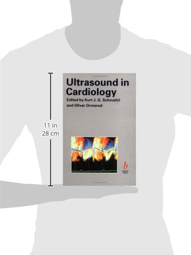 Ultrasound in Cardiology - Retail Maharaj
