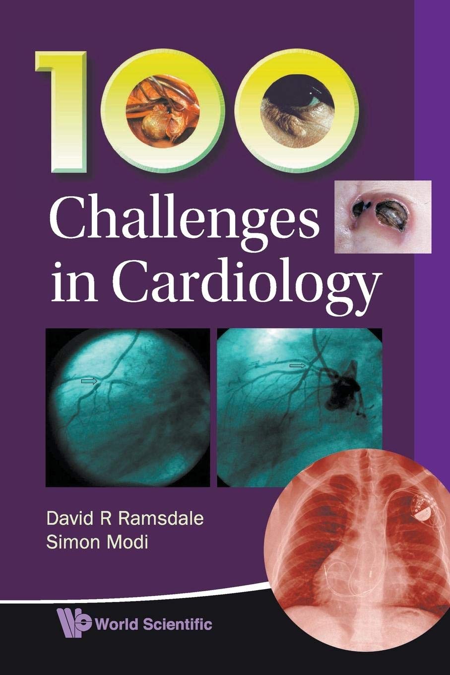 100 Challenges In Cardiology - Retail Maharaj