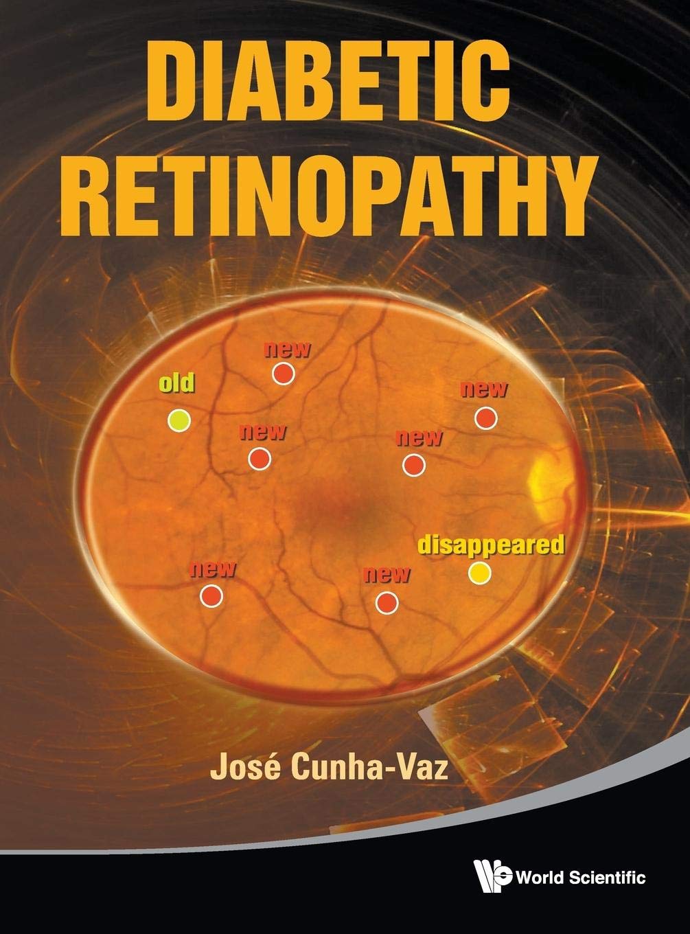 Diabetic Retinopathy - Retail Maharaj