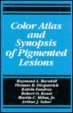 Color Atlas and Synopsis of Pigmented Lesions