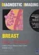 (OLD)DIAGNOSTIC IMAGING: BREAST (IE)