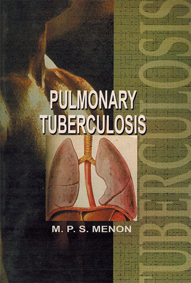 PULMONARY TUBERCULOSIS - Retail Maharaj