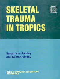 Skeletal Trauma In Tropics