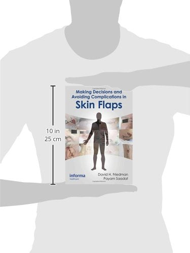 Making Decisions And Avoiding Complications In Skin Flaps (Ex)