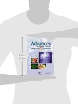 ADVANCES IN HYDATID DISEASE DIAGNOSIS & TREATMENT