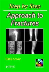 Step by Step Approach to Fractures with Photo CD-ROM