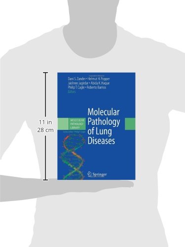 Molecular Pathology of Lung Diseases: 1 (Molecular Pathology Library)