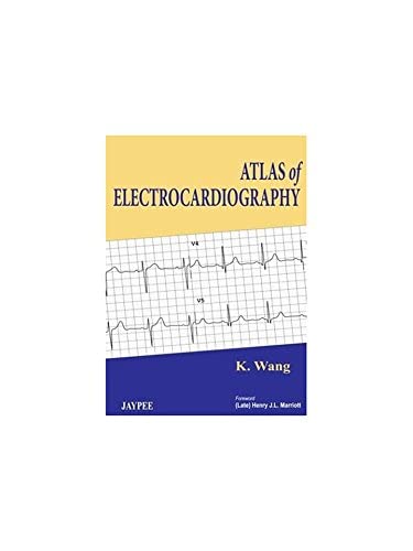 Atlas of Electrocardiography