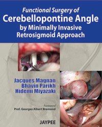 FUNCTIONAL SURGERY OF CEREBELLOPONTINE ANGLE BY MINIMALLY INVASIVE RETROSIGMOID APPROACH