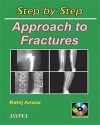 STEP BY STEP APPROACH TO FRACTURES WITH CD-ROM