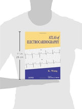 Atlas of Electrocardiography