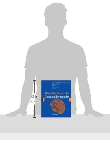 Atlas of Cardiovascular Computed Tomography