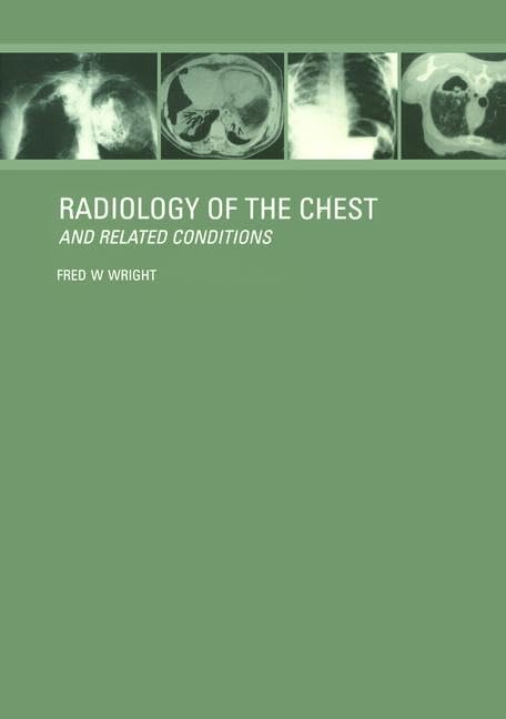 RADIOLOGY OF THE CHEST AND RELATED CONDITIONS WITH CD-ROM: Together with an extensive illustrative collection of radiographs, conventional and ... for Mac and Windows version 3.1 or later)