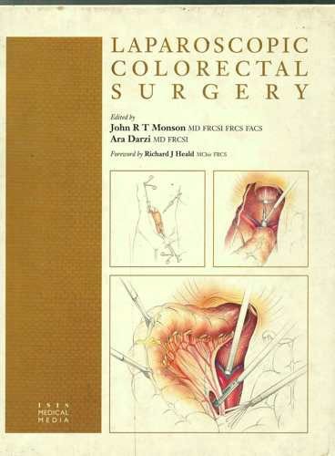 Laparoscopic Colorectal Surgery