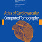 Atlas of Cardiovascular Computed Tomography