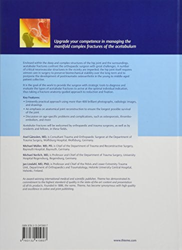 Acetabular Fractures: Diagnosis, Indications, Treatment Strategies - Retail Maharaj