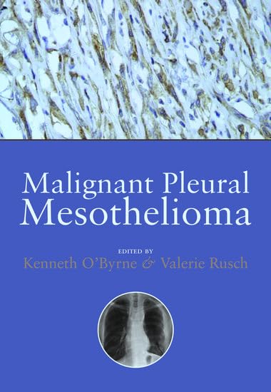 Malignant Pleural Mesothelioma