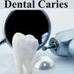 Essentials of Dental Caries