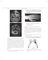 MCQs in Pain Medicine, 2/e | Over 2100 MCQs (PB 2026)