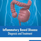 Inflammatory Bowel Disease: Diagnosis and Treatment