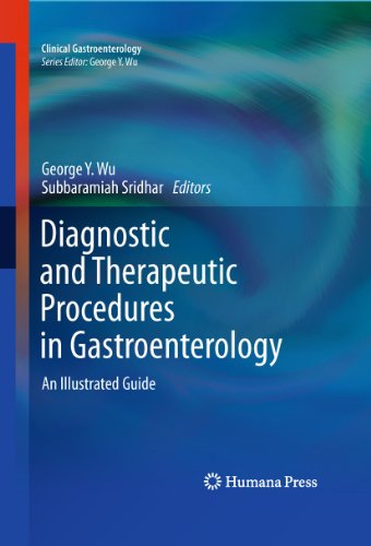 Diagnostic and Therapeutic Procedures in Gastroenterology: An Illustrated Guide (Clinical Gastroenterology)