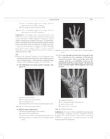 MCQs in Pain Medicine, 2/e | Over 2100 MCQs (PB 2026)