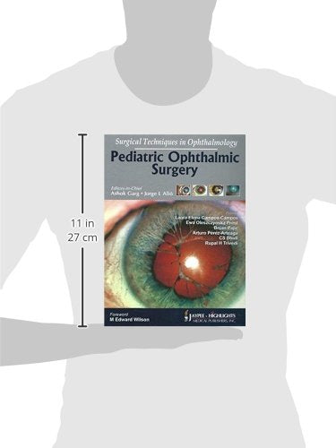 Pediatric Ophthalmic Surgery Surgical Techniques In Ophthalmology