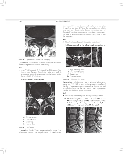 MCQs in Pain Medicine, 2/e | Over 2100 MCQs (PB 2026)