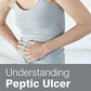 Understanding Peptic Ulcer Disease