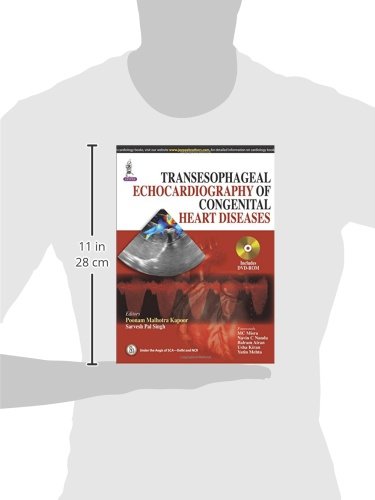 TRANSESOPHAGEAL ECHOCARDIOGRAPHY OF CONGENITAL HEART DISEASES