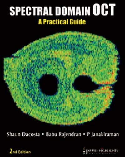 SPECTRAL DOMAIN OCT A PRACTICAL GUIDE
