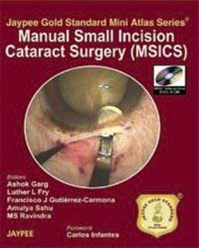 MANUAL SMALL INCISION CATARACT SURGERY (MSICS) WITH DVD-ROM JAYPEE GOLD STANDARD MINIATLAS