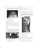 MCQs in Pain Medicine, 2/e | Over 2100 MCQs (PB 2026)