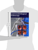 Gastroenterological Endoscopy