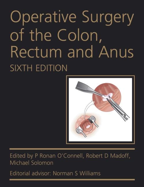 OPERATIVE SURGERY OF THE COLON,RECTUM AND ANUS