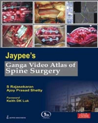 Jaypee’s Ganga Video Atlas of Spine Surgery Over 50 Procedures in 6 DVDs