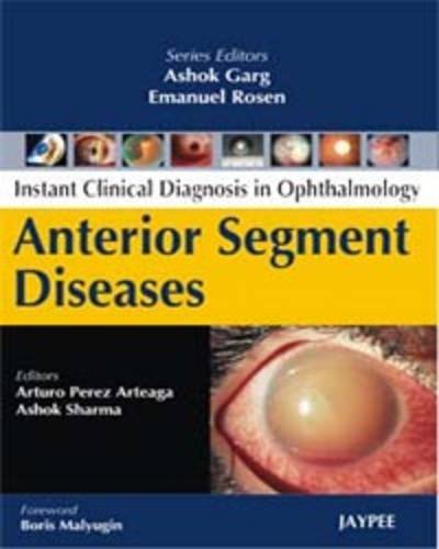 Instant Clinical Diagnosis in Ophthalmology: Anterior Segment Diseases (POD)
