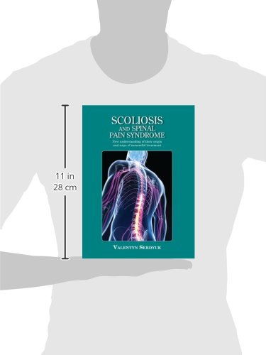 Scoliosis and spinal pain syndrome: New understanding of their origin and ways of successful treatment - Retail Maharaj