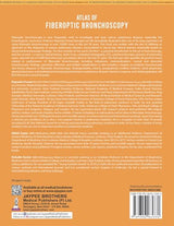 ATLAS OF FIBEROPTIC BRONCHOSCOPY