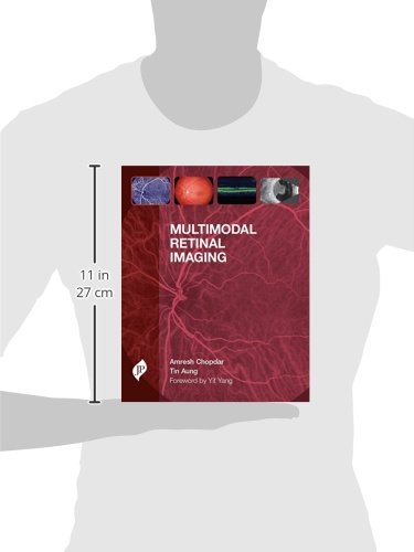 Multimodal Retinal Imaging