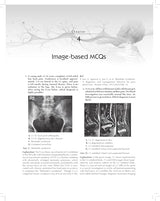 MCQs in Pain Medicine, 2/e | Over 2100 MCQs (PB 2026)